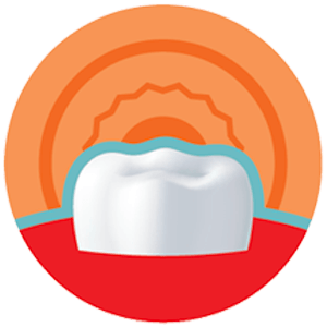 מניעת רגישות בשיניים